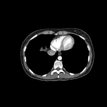 PhantomX Abdomen Phantom