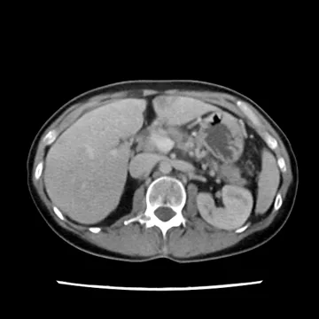 PhantomX Abdomen Phantom