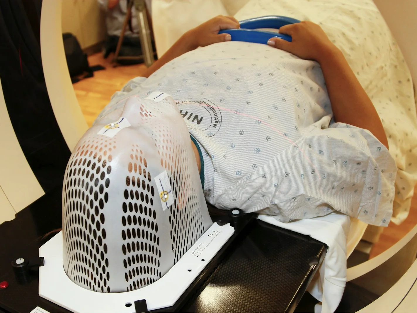 Patient immobilized in a thermoplastic mask for radiotherapy